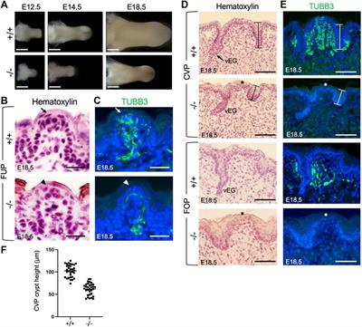 The role of Eya1 and Eya2 in the taste system of mice from embryonic stage to adulthood